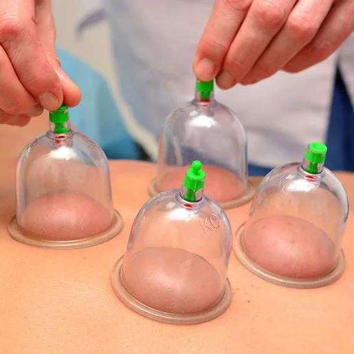 Wet & Dry Cupping